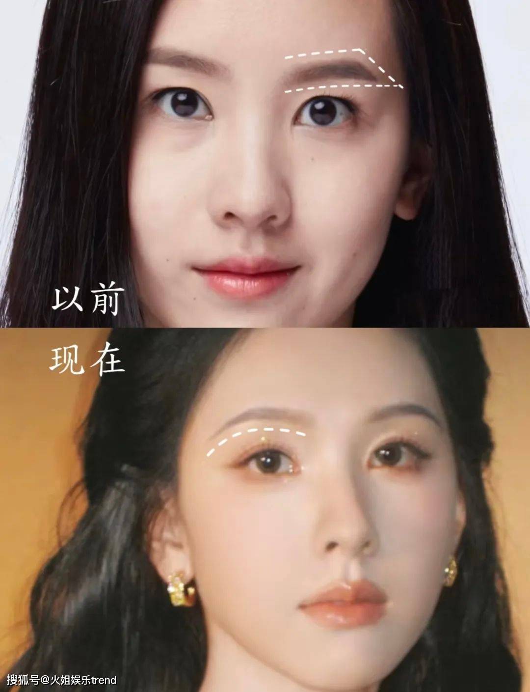 陈都灵是不是医美了？